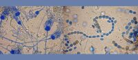 Mold & Indoor Air Quality